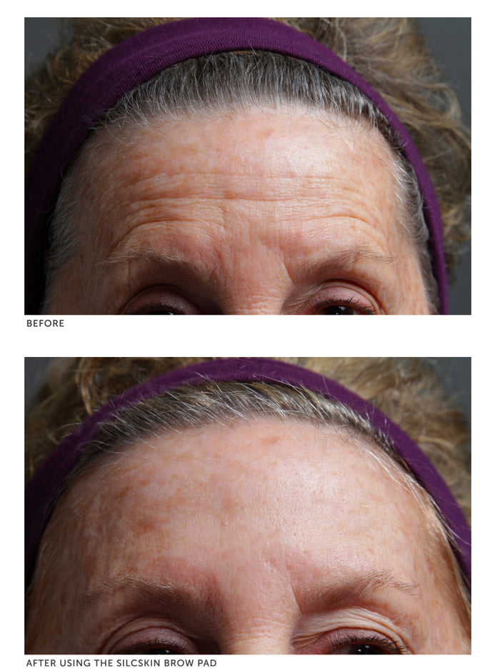 SilcSkin Brow Pads