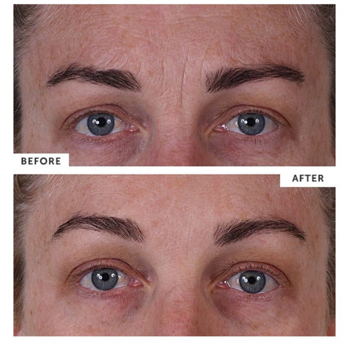 SilcSkin Full Face Set